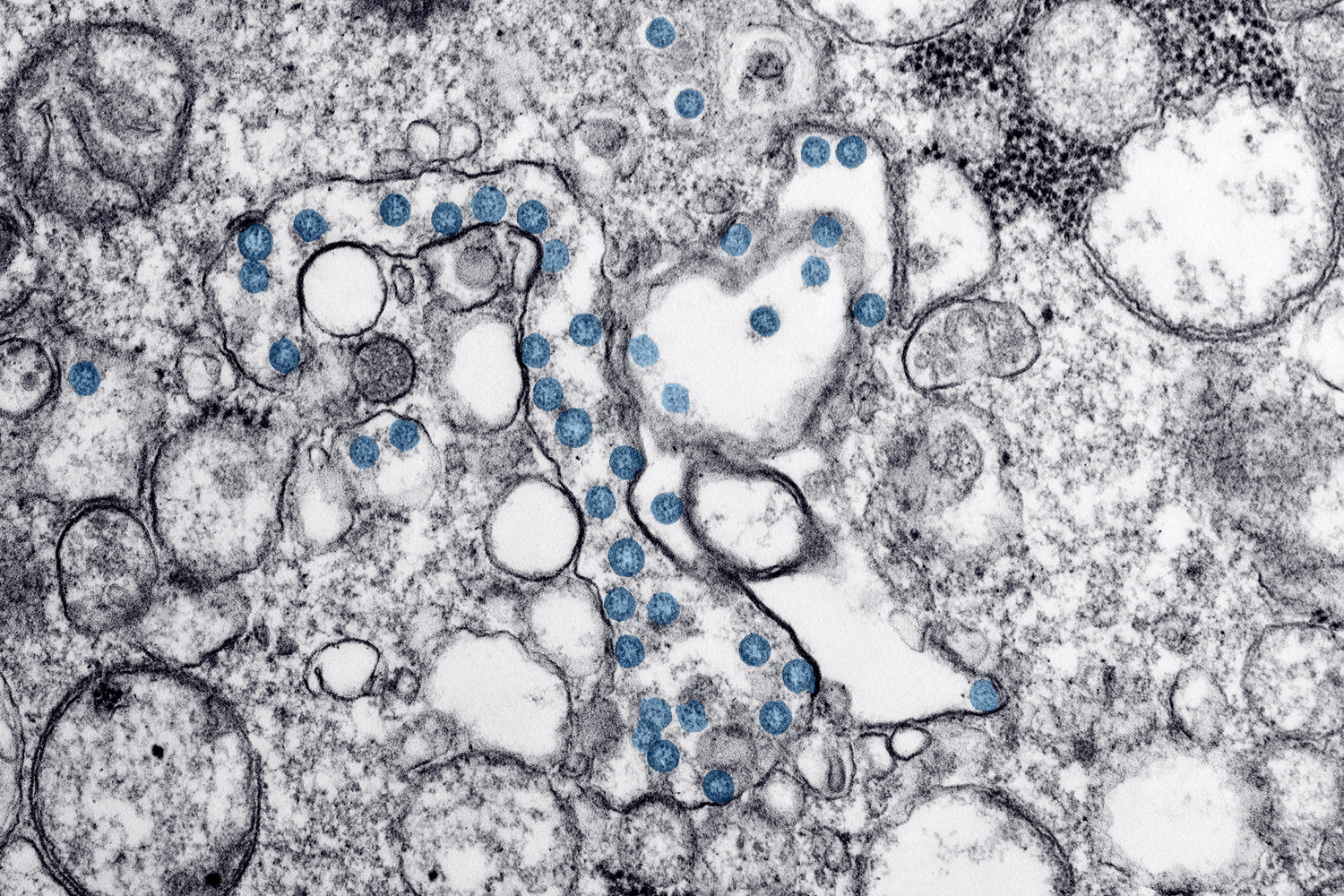Can I Take Probiotics with Antibiotics? Demystifying the Biome Balance